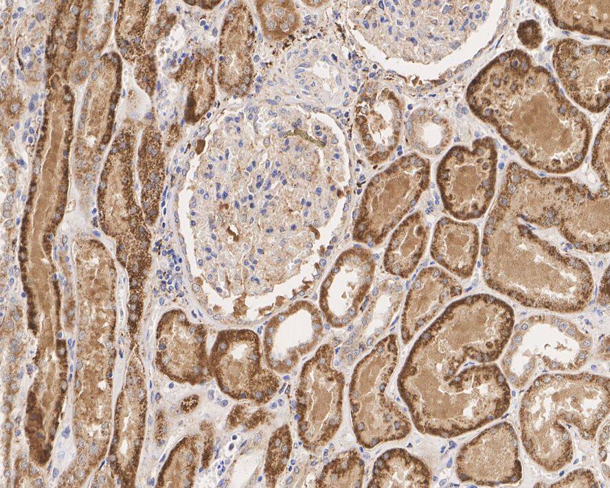 LMW-PTP/ACP1 Antibody (PSH04-57)