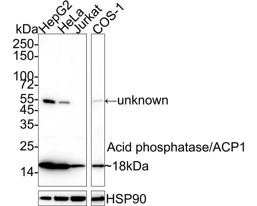 LMW-PTP/ACP1 Antibody (PSH04-57)
