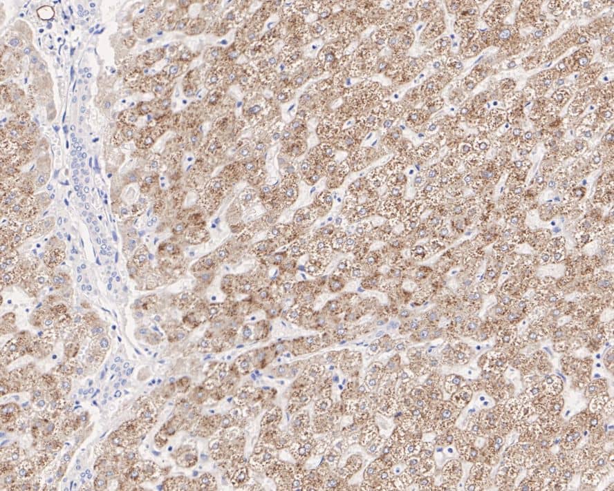 ACSL5 Antibody (A9D3-R)