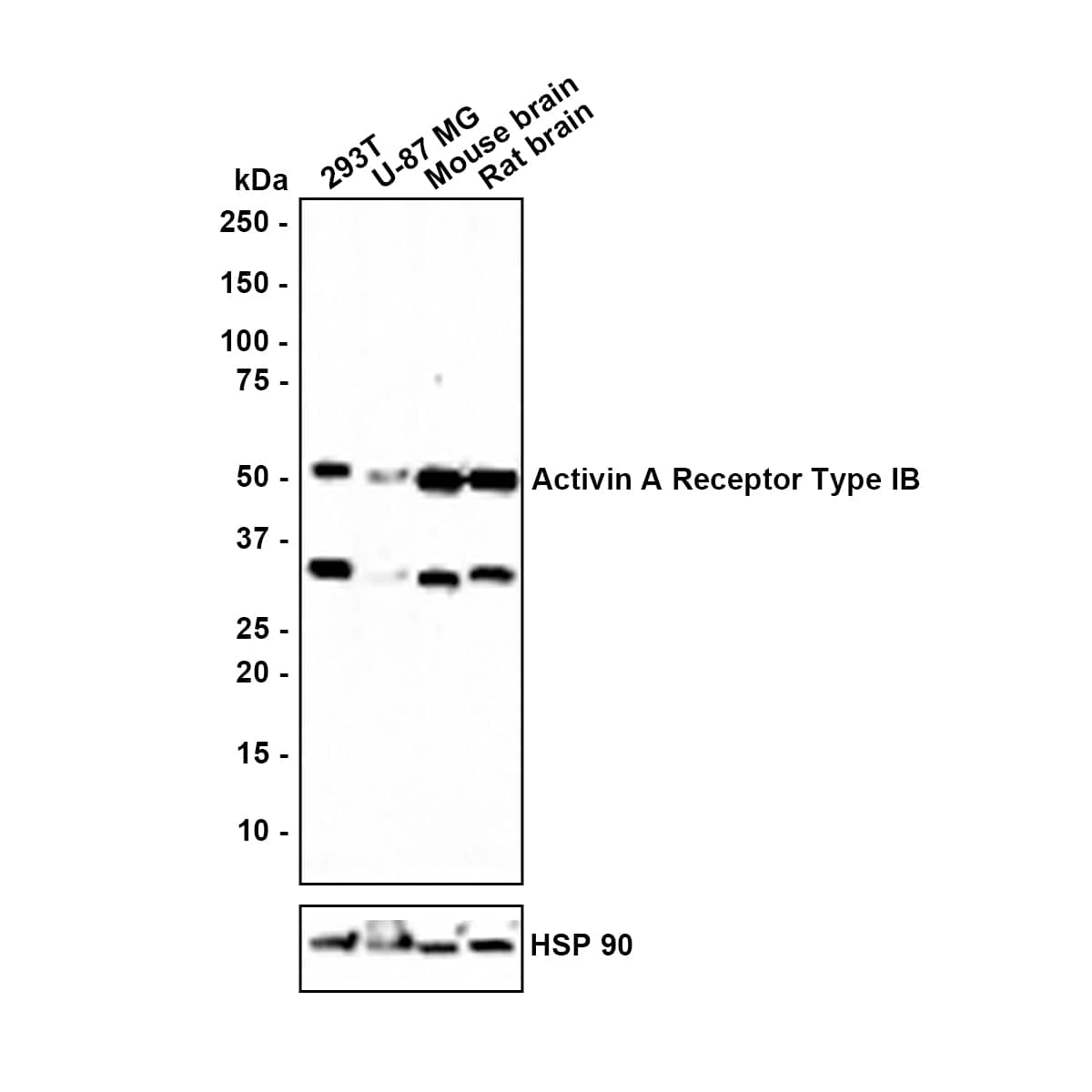 Activin RIB/ALK-4 Antibody (JE38-48) Western Blot: Activin RIB/ALK-4 Antibody (JE38-48) [NBP3-31998]