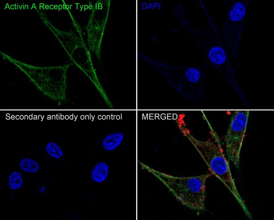 Activin RIB/ALK-4 Antibody (JE38-48)