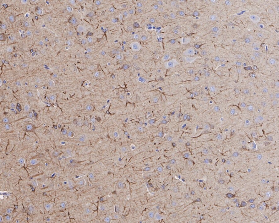 Activin RIB/ALK-4 Antibody (JE38-48)