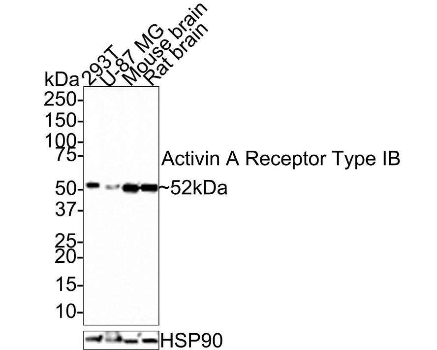 Activin RIB/ALK-4 Antibody (JE38-48)