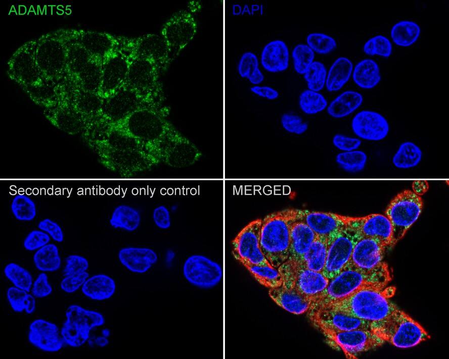 ADAMTS5 Antibody (PSH03-52)