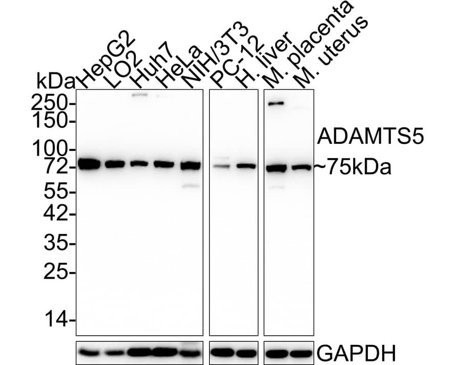 ADAMTS5 Antibody (PSH03-52)