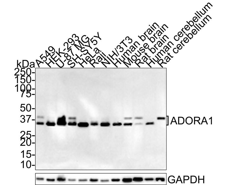 Adenosine A1R Antibody (JE31-35)