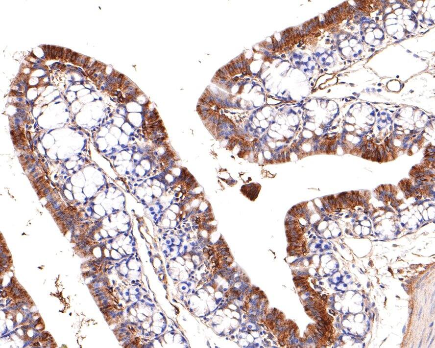 Adiponectin/Acrp30 Antibody (JE65-49)