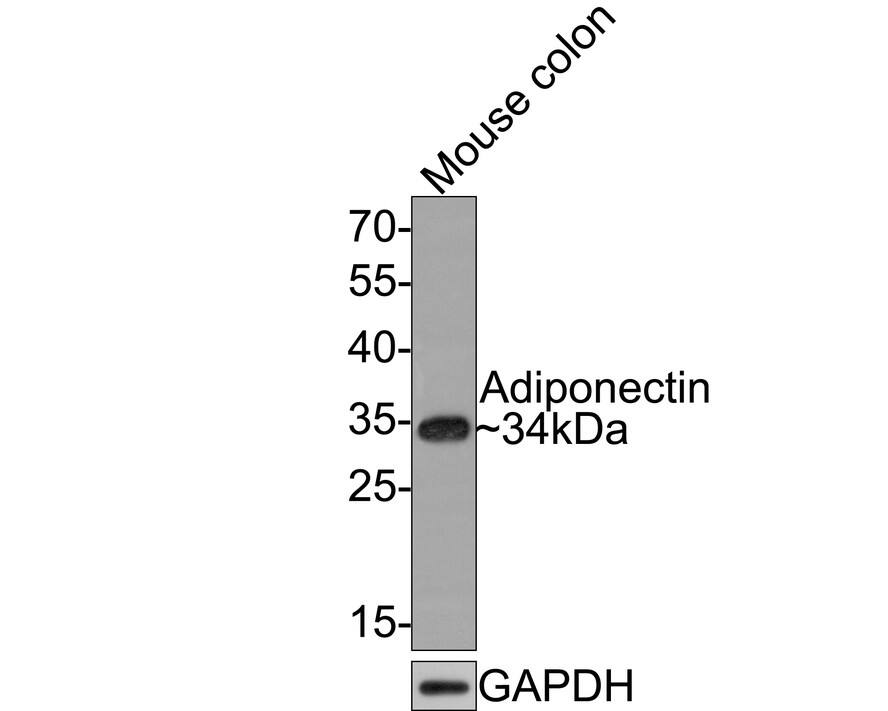 Adiponectin/Acrp30 Antibody (JE65-49)