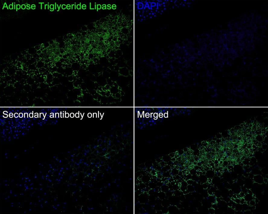 PEDFR/PNPLA2/ATGL Antibody (JE37-49)