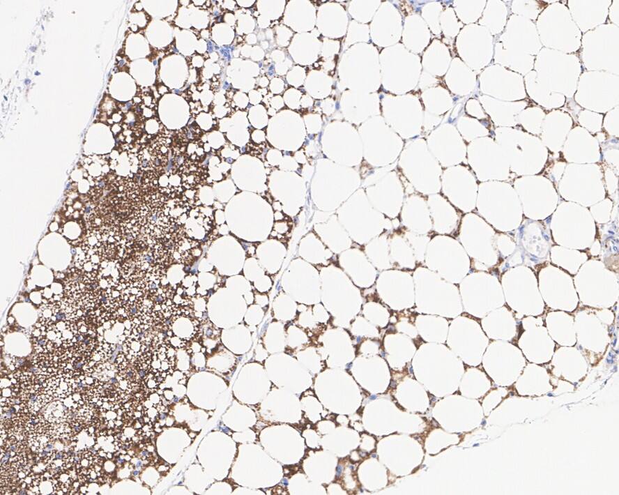 PEDFR/PNPLA2/ATGL Antibody (JE37-49)