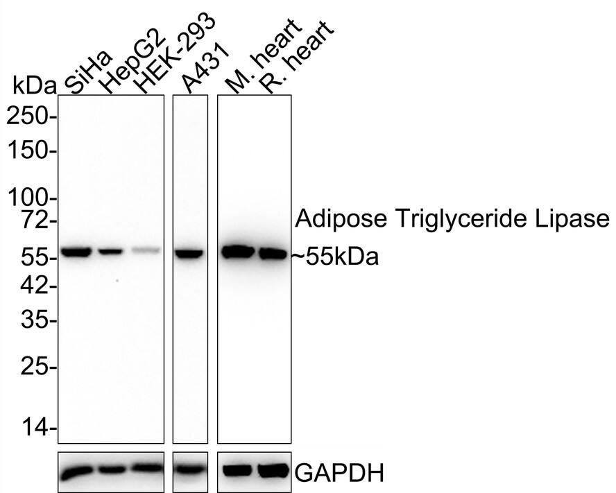 PEDFR/PNPLA2/ATGL Antibody (JE37-49)