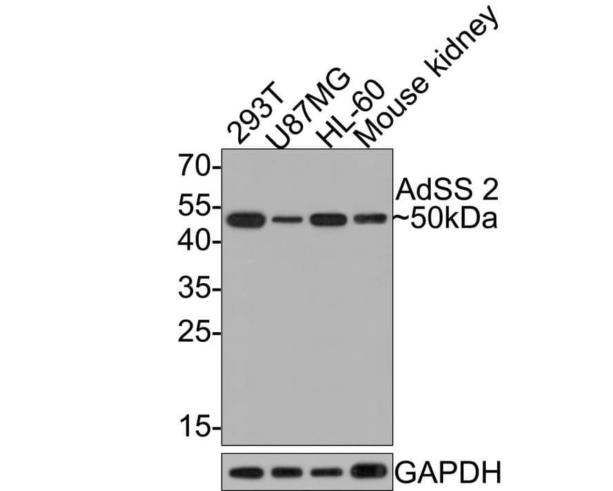 Adenylosuccinate Synthase Antibody (JE64-42)