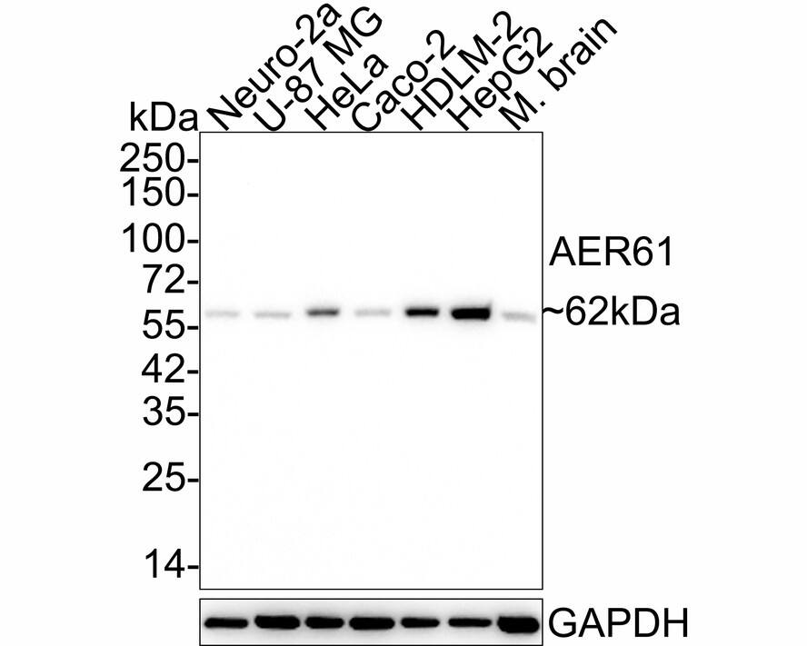 EOGT/AER61 Antibody (JE64-87) Western Blot: EOGT/AER61 Antibody (JE64-87) [NBP3-32007]