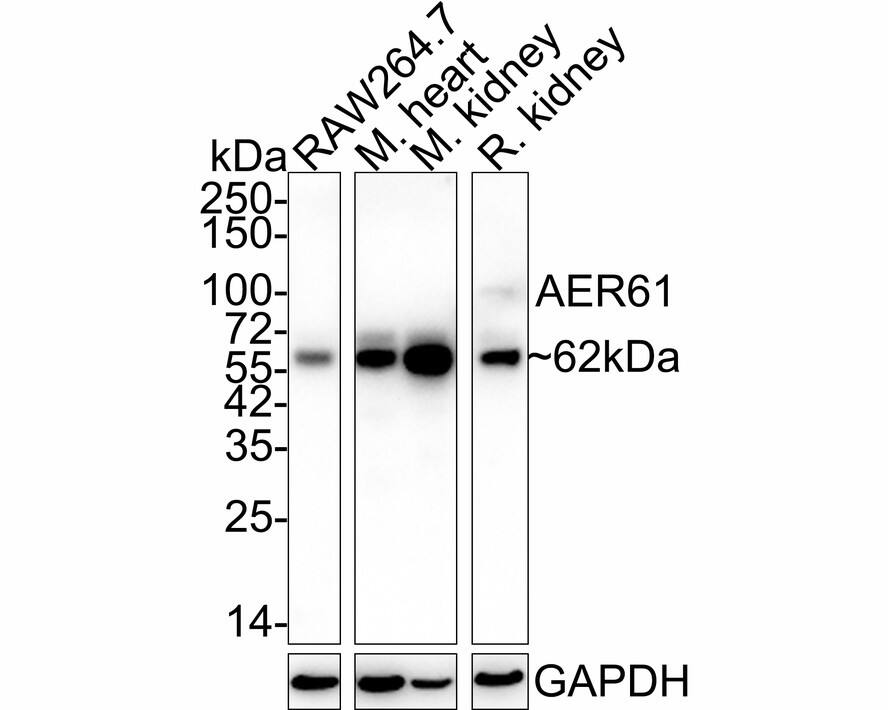 EOGT/AER61 Antibody (JE64-87) Western Blot: EOGT/AER61 Antibody (JE64-87) [NBP3-32007]