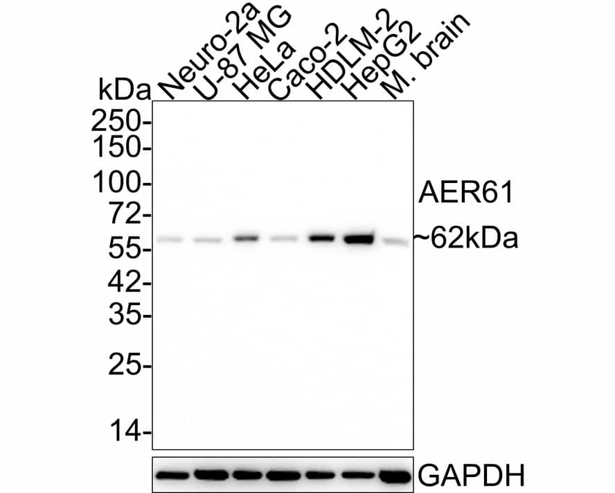 EOGT/AER61 Antibody (JE64-87)