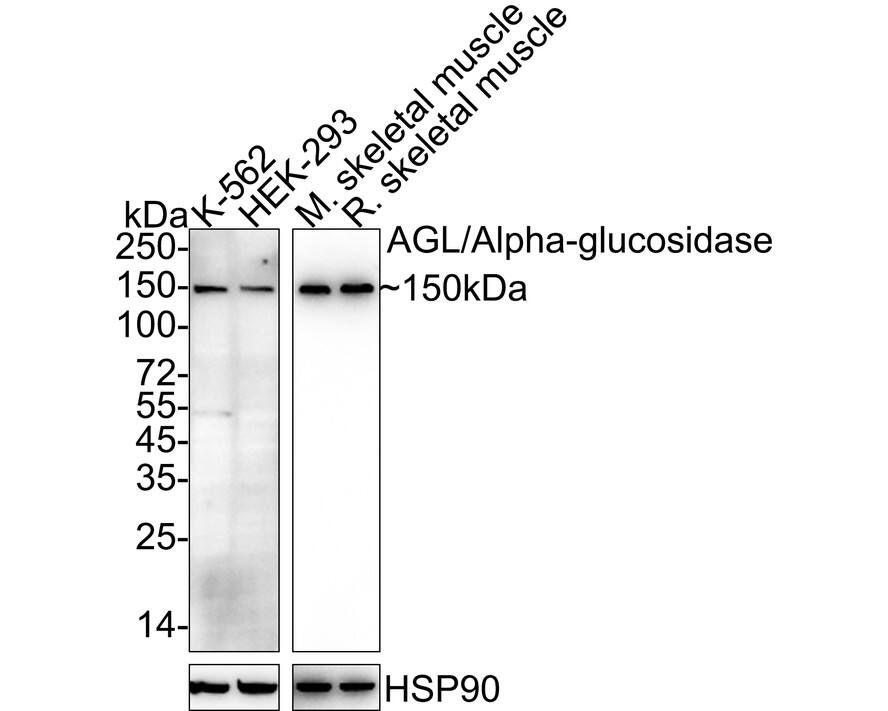AGL Antibody (PSH04-56)