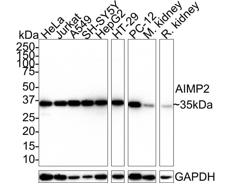 AIMP2 Antibody (PSH0-75)