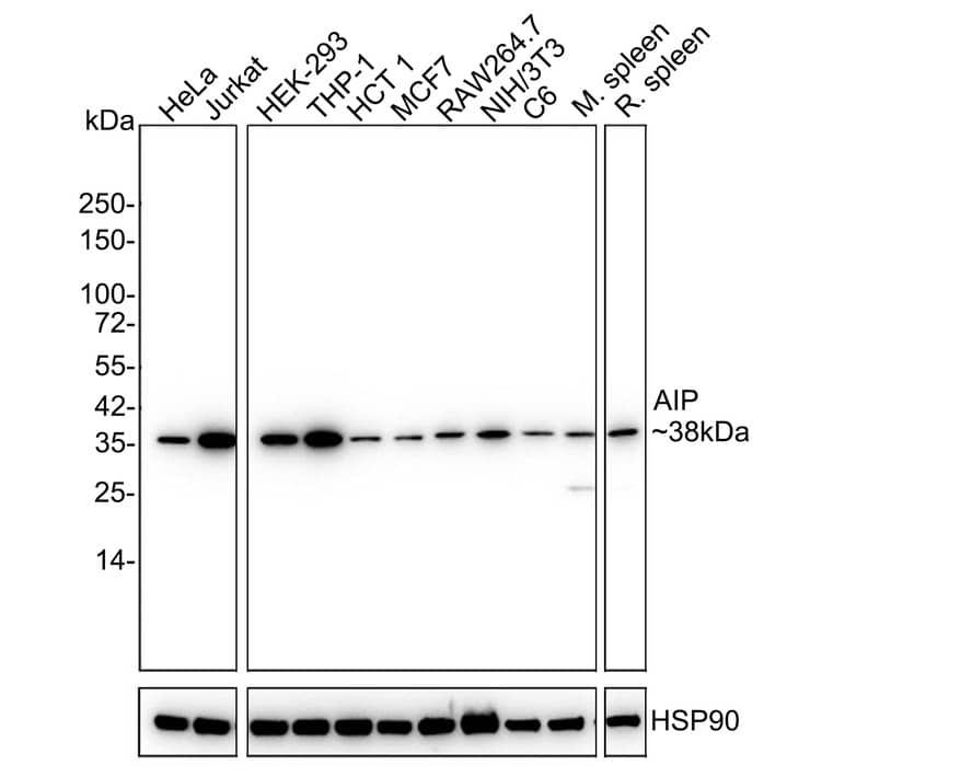 AIP/ARA9 Antibody (PSH03-17)