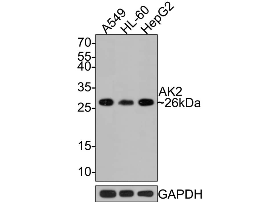 AK2 Antibody (JE64-27)