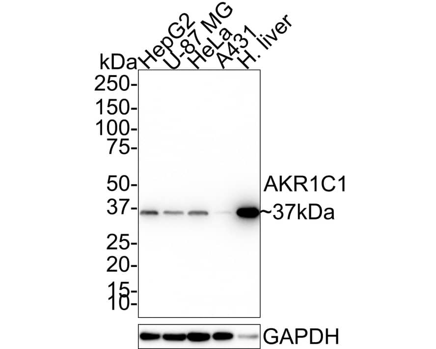 Aldo-keto Reductase 1C1/AKR1C1 Antibody (5-F10-R)