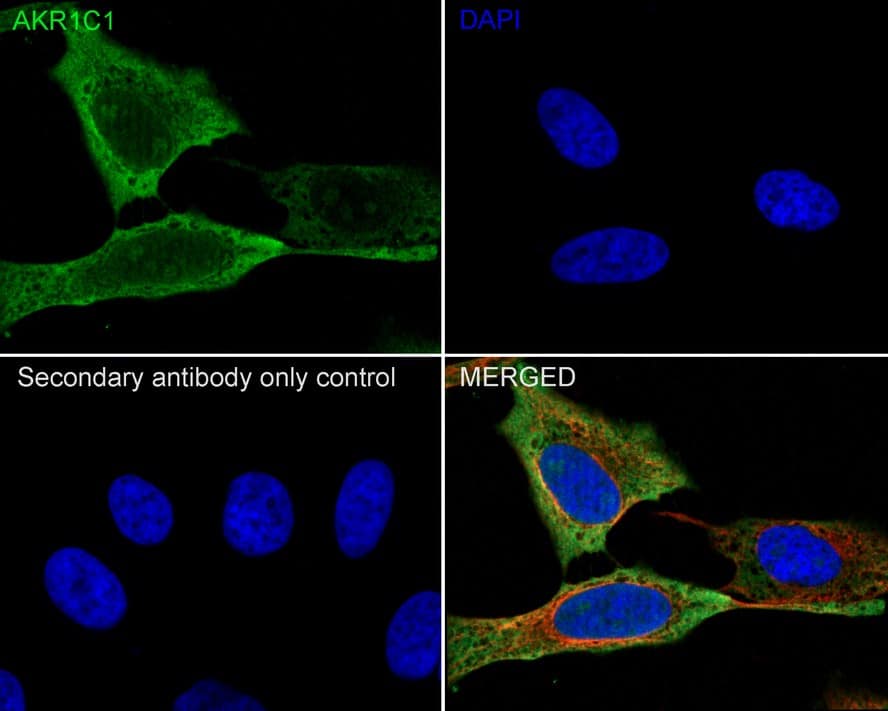 Aldo-keto Reductase 1C1/AKR1C1 Antibody (5-F10-R)