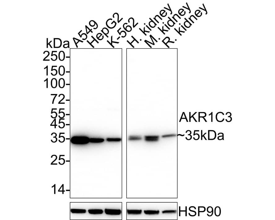 Aldo-keto Reductase 1C3/AKR1C3 Antibody (JE36-28)