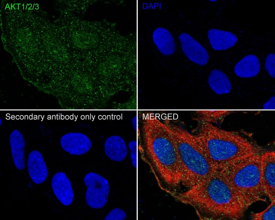 AKT1/2/3 Antibody (JE75-09)