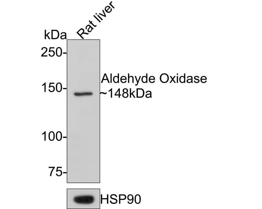 Aldehyde Oxidase 1/AOX1 Antibody (PSH0-17)