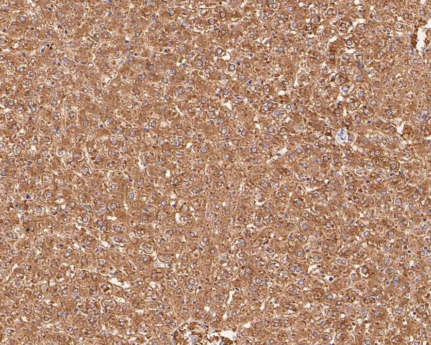 Aldehyde Oxidase 1/AOX1 Antibody (PSH0-17)