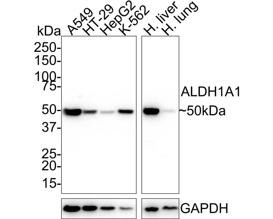 Aldehyde Dehydrogenase 1-A1/ALDH1A1 Antibody (8F1-R)