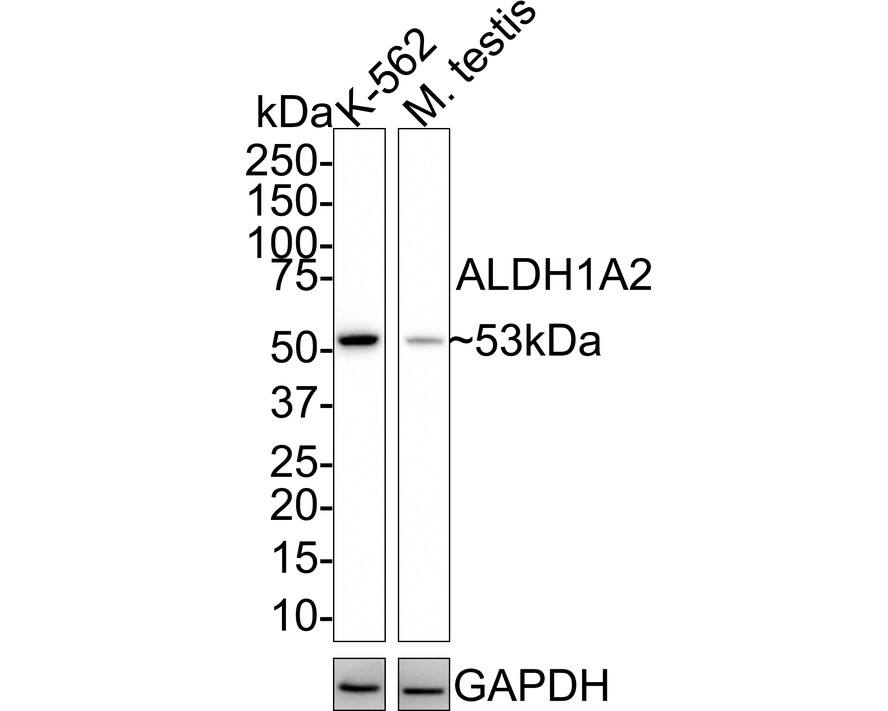 ALDH1A2 Antibody (JE41-38) Western Blot: ALDH1A2 Antibody (JE41-38) [NBP3-32020]