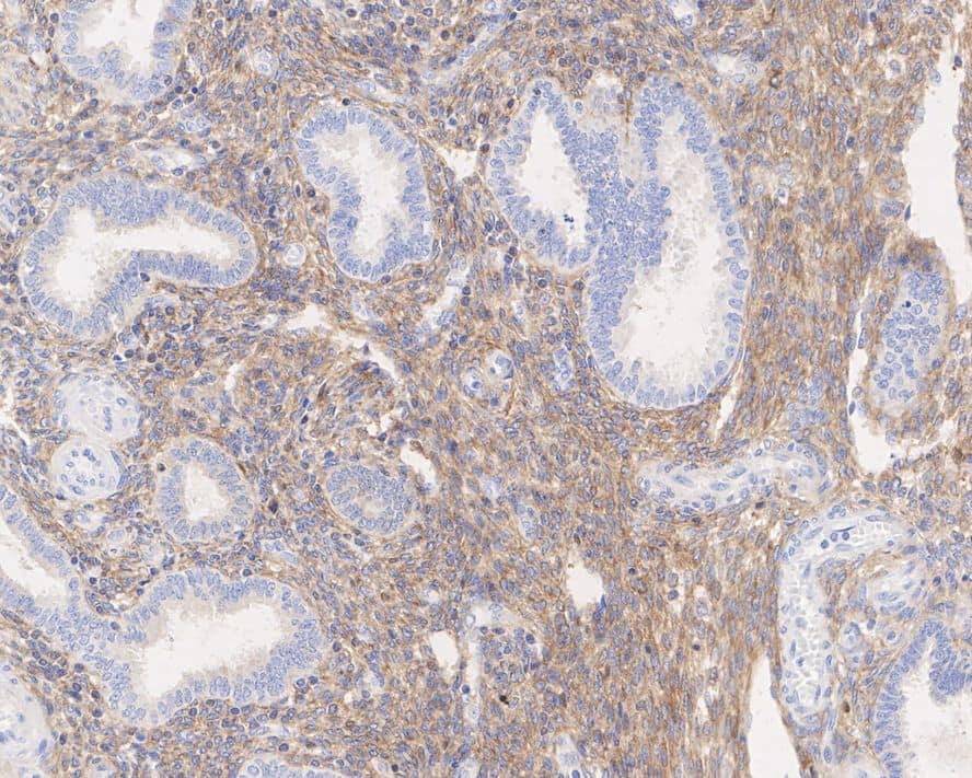 ALDH1A2 Antibody (JE41-38)