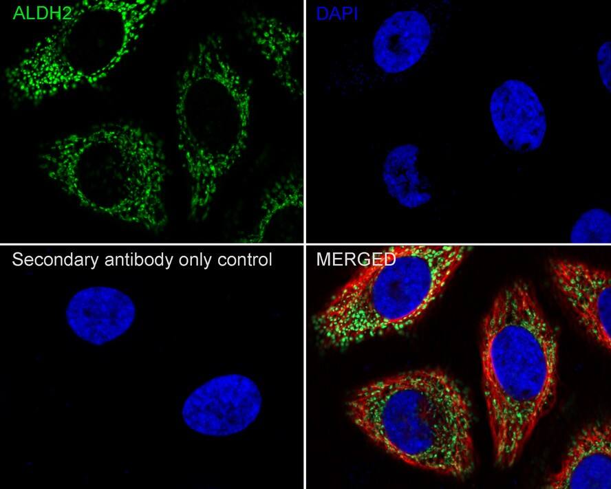 ALDH2 Antibody (E4-D10-R)