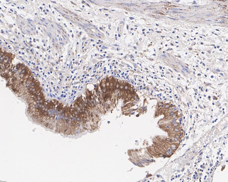 ALDH2 Antibody (E4-D10-R)