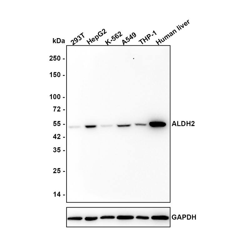 ALDH2 Antibody (7-D8-R) Western Blot: ALDH2 Antibody (7-D8-R) [NBP3-32022]