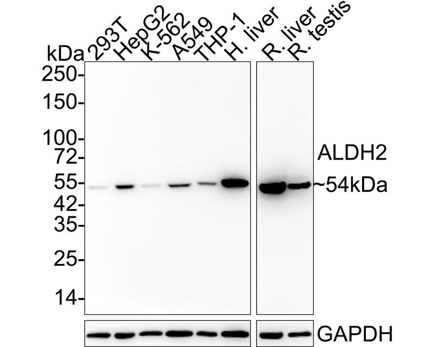 ALDH2 Antibody (7-D8-R)