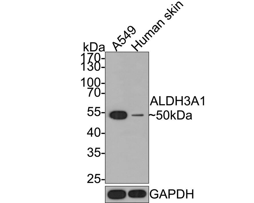 Aldehyde Dehydrogenase 3-A1/ALDH3A1 Antibody (PD00-73)