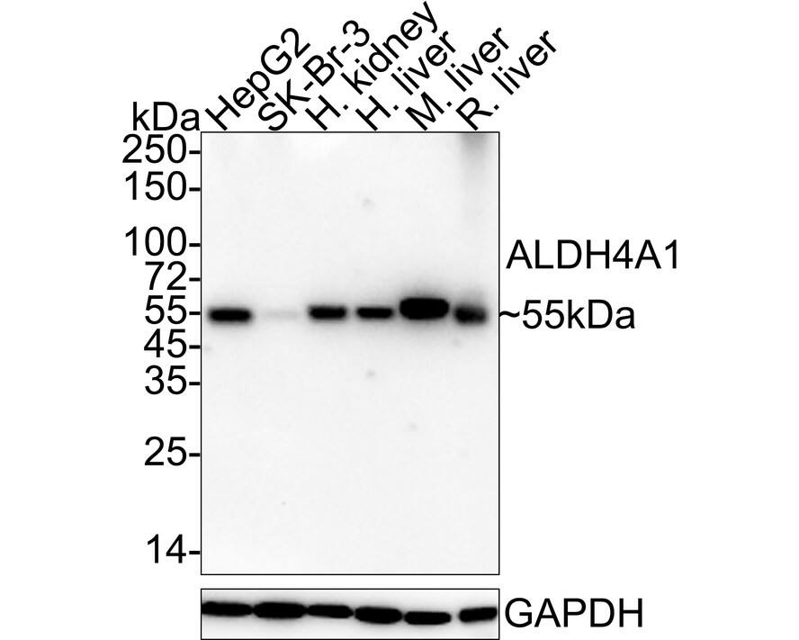 ALDH4A1 Antibody (7E2-R) Western Blot: ALDH4A1 Antibody (7E2-R) [NBP3-32024]