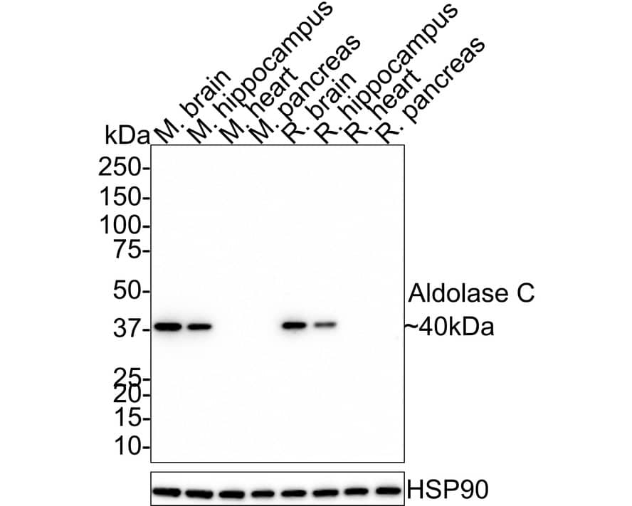 Aldolase C Antibody (PSH01-82)