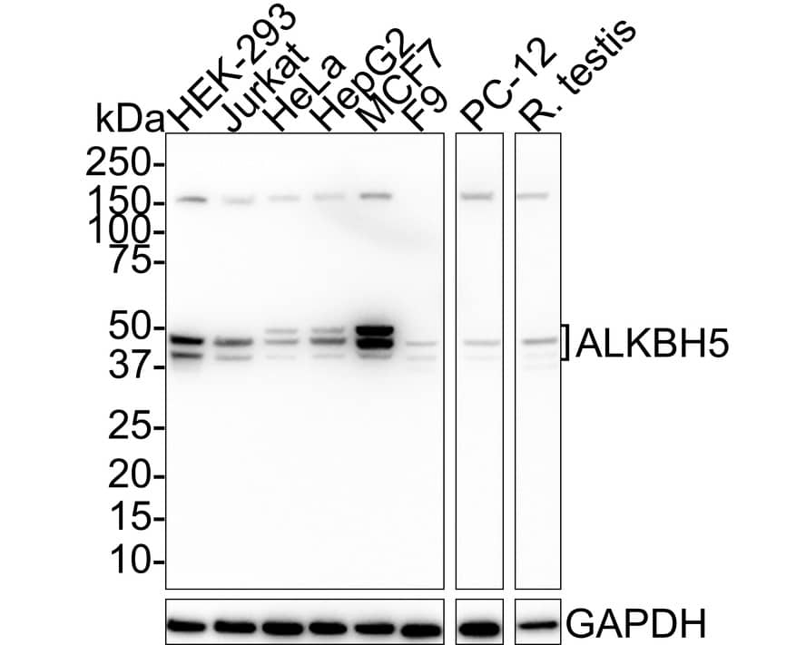 ALKBH5 Antibody (PSH01-16)