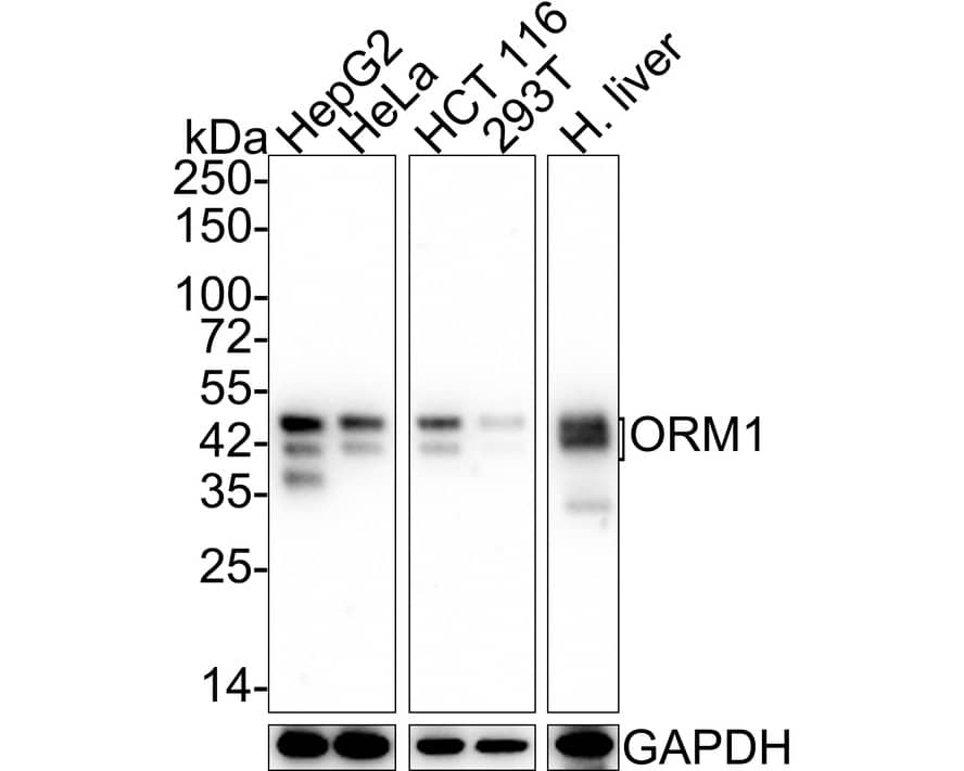 alpha 1-Acid Glycoprotein Antibody (A4-G2-A3-R)