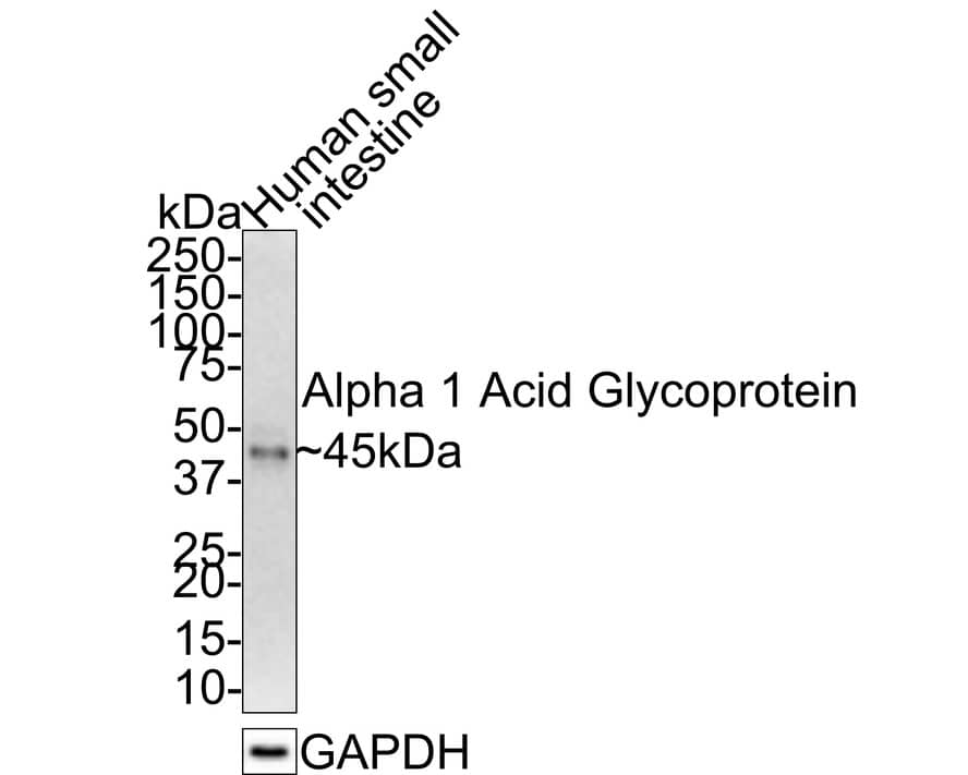 alpha 1-Acid Glycoprotein Antibody (JE31-16)