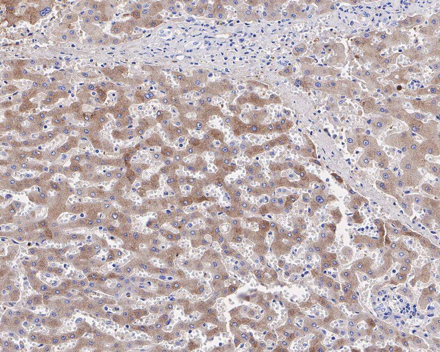 alpha 1-Acid Glycoprotein Antibody (JE31-16)