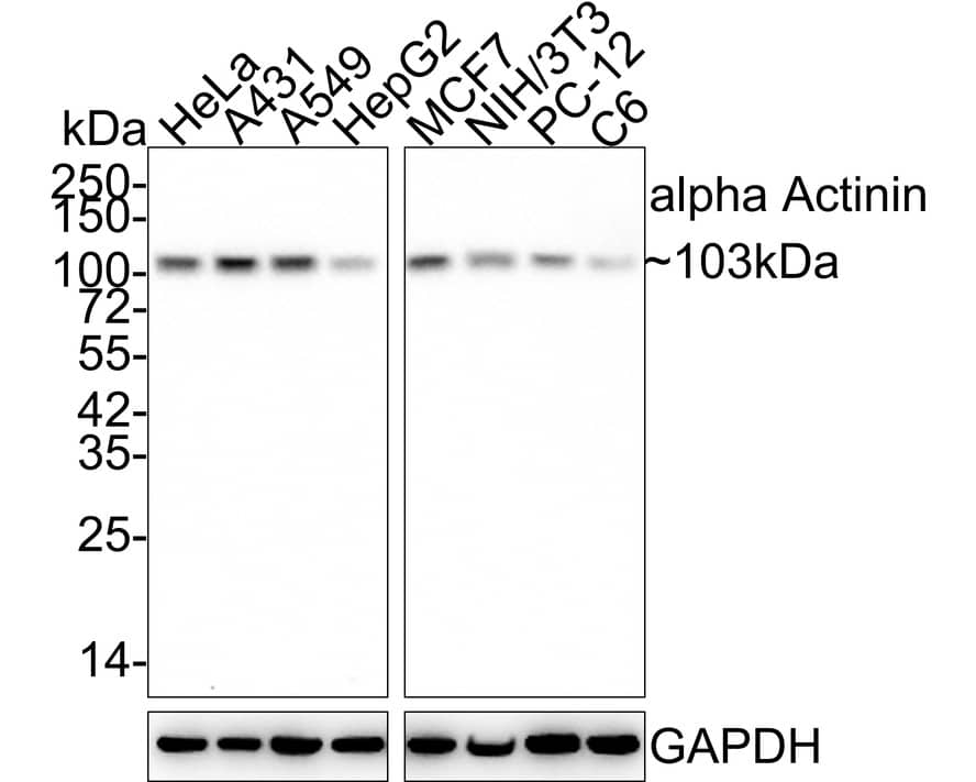 alpha-Actinin 1 Antibody (A1G2-R)