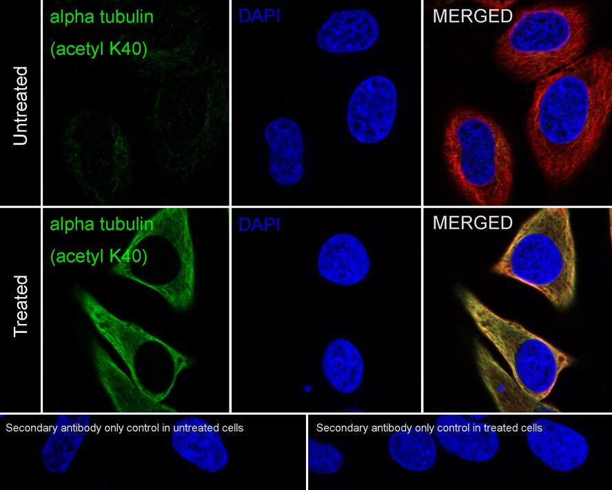 Tubulin alpha-1B [ac Lys40] Antibody (PSH0-13)
