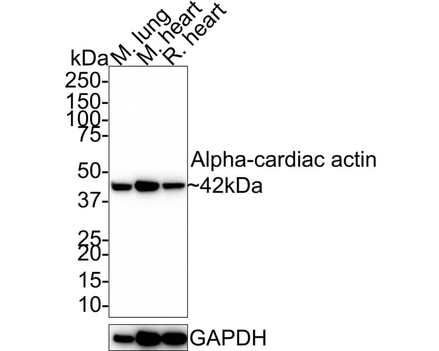 Actin Alpha 1 Cardiac Muscle Antibody (33-32-R)