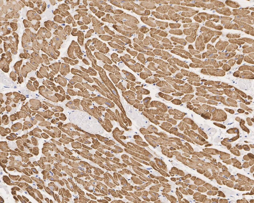Actin Alpha 1 Cardiac Muscle Antibody (33-32-R)