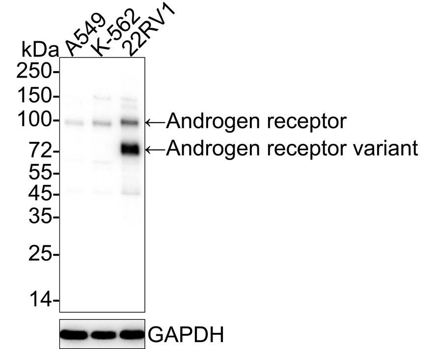 Androgen R/NR3C4 Antibody (PO00-29) Western Blot: Androgen R/NR3C4 Antibody (PO00-29) [NBP3-32035]