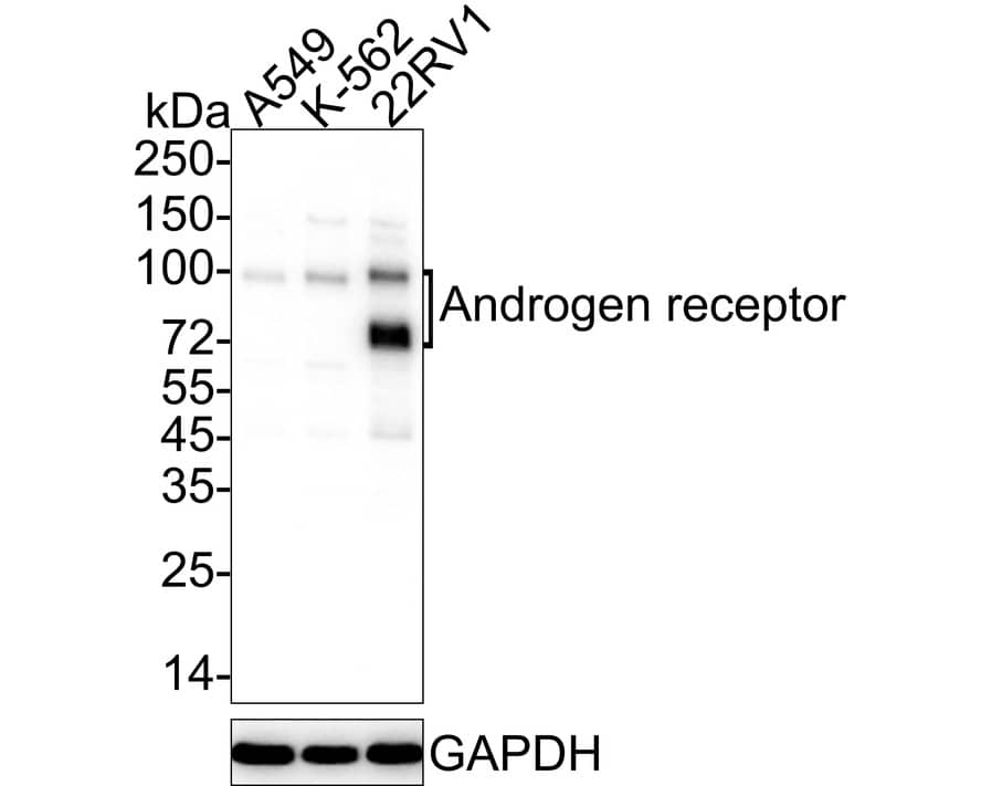 Androgen R/NR3C4 Antibody (PO00-29)