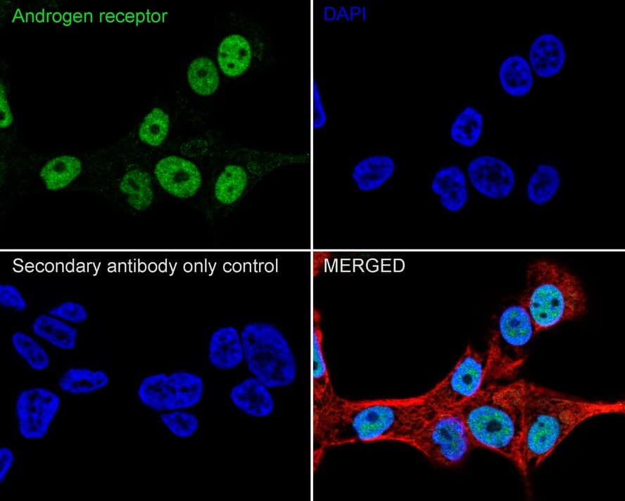 Androgen R/NR3C4 Antibody (PO00-29)